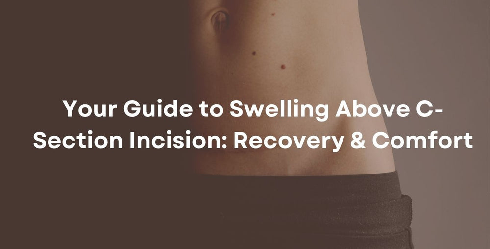 Your Guide to Swelling Above C-Section Incision: Recovery & Comfort