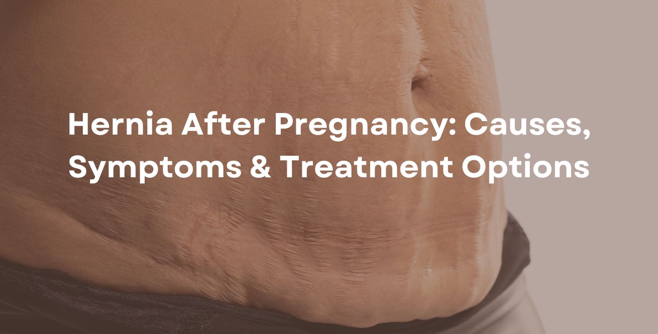 Hernia After Pregnancy Causes, Symptoms & Treatment Options