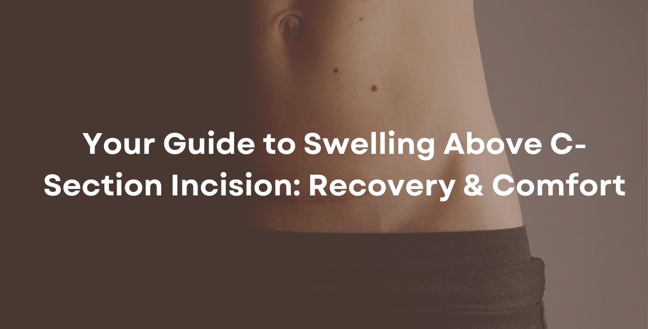 swollen lips after c-section How to Reduce Swelling C-Section: Expert Recovery Tips C-Section Recovery: Swelling, Bruising &