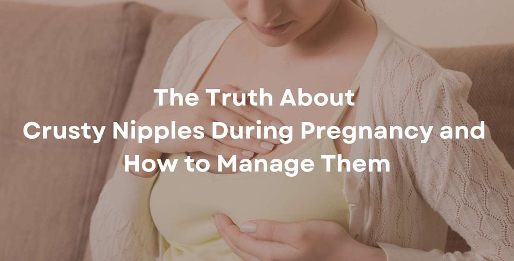 The Truth About Crusty Nipples During Pregnancy and How to Manage Them