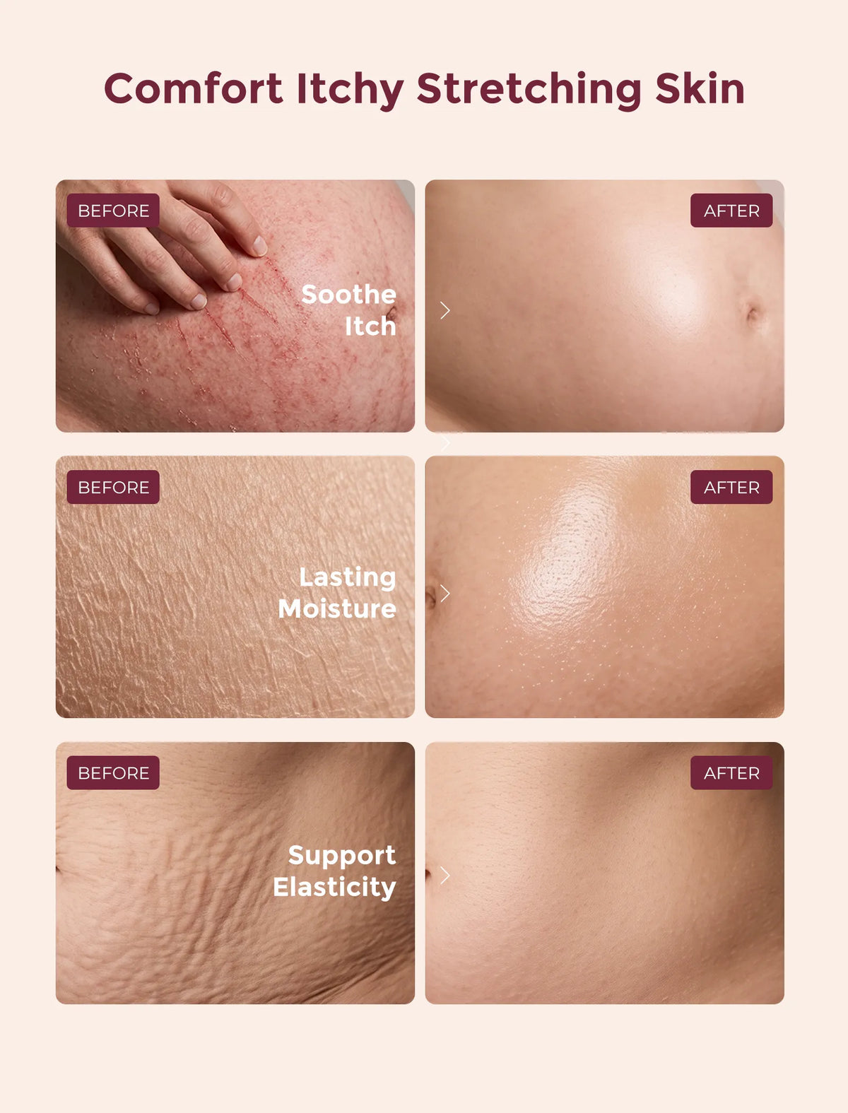 Momcozy Pro-Collagen Belly Firming Moisturizer